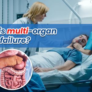 What is Multi-Organ Failure? What Causes it? Can it be Reversed?