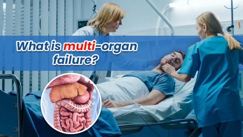 What is Multi-Organ Failure? What Causes it? Can it be Reversed?