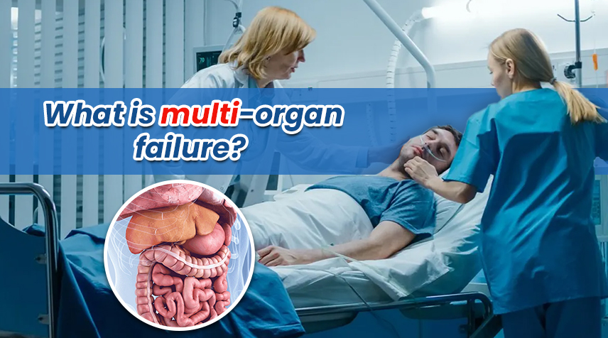 What is Multi-Organ Failure? What Causes it? Can it be Reversed?