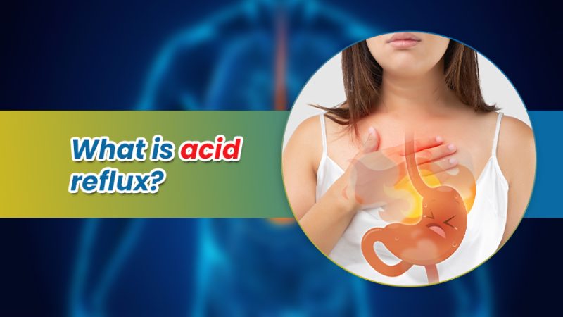 Acid Reflux Disease