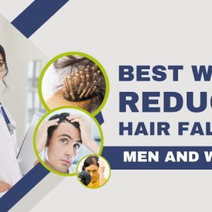 Best Ways to Reduce Hair Fall In Men and Women